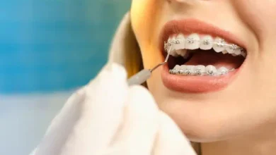 Why Orthodontic Treatment Is Crucial for Long-Term Dental Health