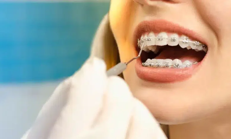 Why Orthodontic Treatment Is Crucial for Long-Term Dental Health